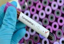فهرست جدید آزمایشگاه‌های مجاز تشخیص کرونا اعلام شد