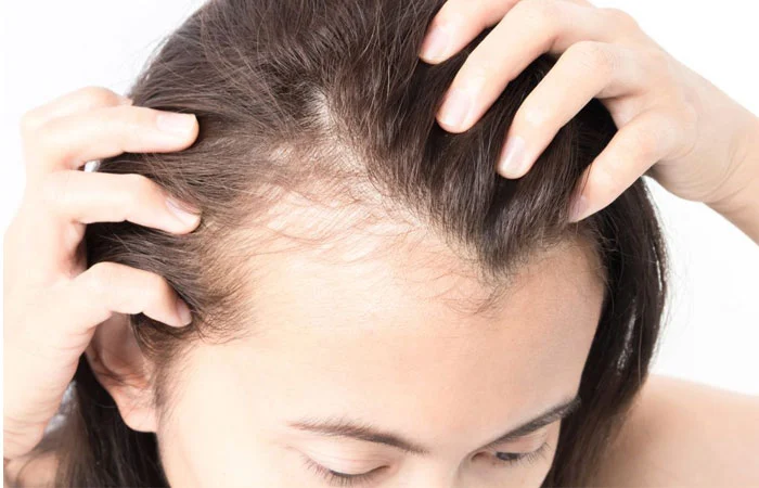 Finasteride tablets How to use, side effects and effect on hair loss treatment