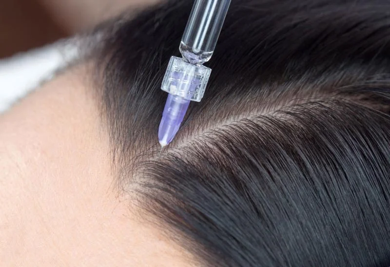 How to cure hair loss fast