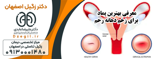 درمان سریع تبخال تناسلی در اصفهان