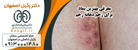 درمان سریع تبخال تناسلی در اصفهان