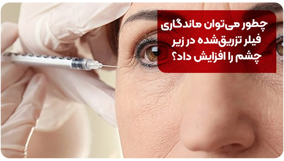 چطور می&zwnj;توان ماندگاری فیلر تزریق&zwnj;شده در زیر چشم را افزایش داد؟