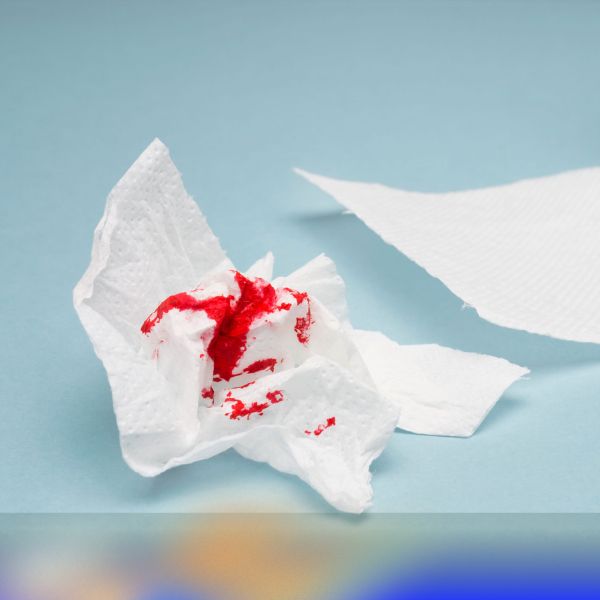 خونریزی مقعدی