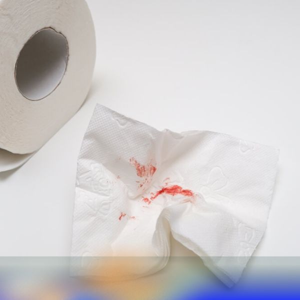 چرا خونریزی مقعدی بده؟