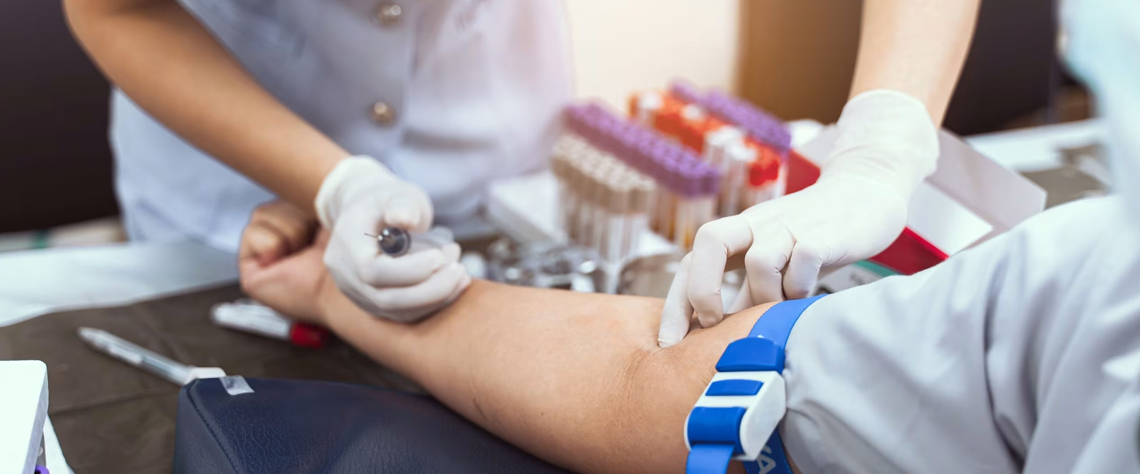 تاثیر سبک زندگی بر نتایج چکاپ مردان