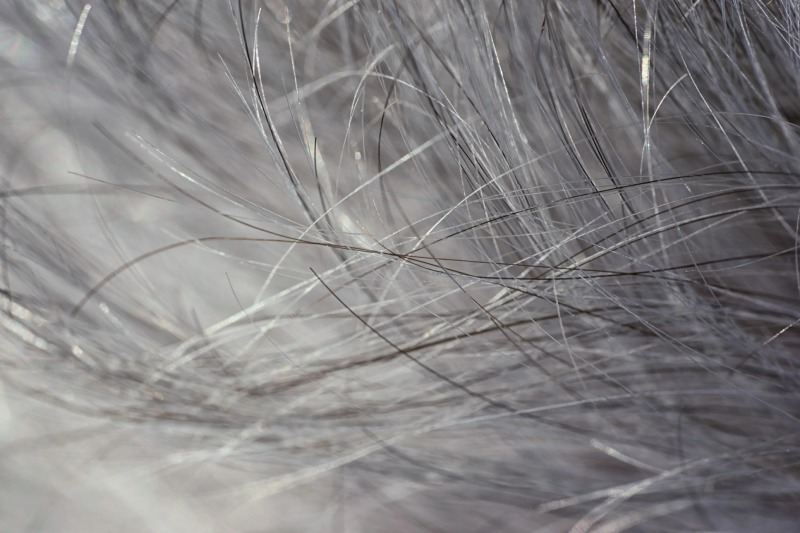 درمان |طب سنتی راهکارهای طب سنتی برای پیشگیری و درمان سفیدی مو